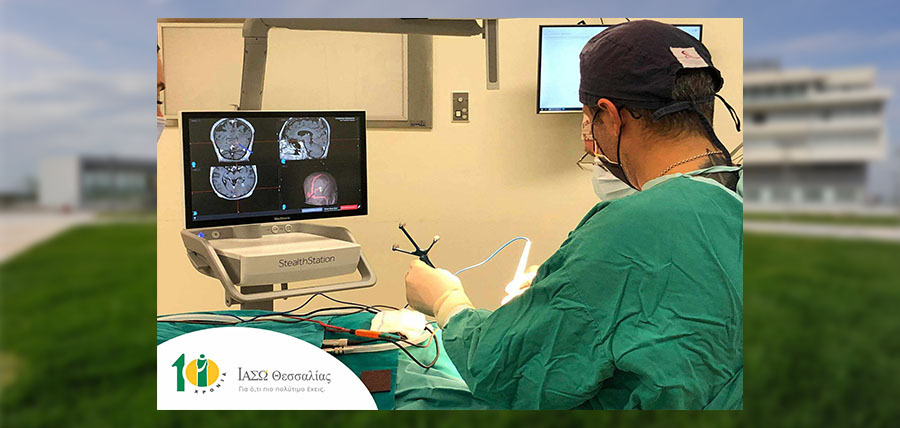 Α΄ Νευροχειρουργική Κλινική ΙΑΣΩ Θεσσαλίας: «1η Νευροχειρουργική επέμβαση με το νέο υπερσύγχρονο σύστημα Νευροπλοήγησης StealthStation S8» article cover image