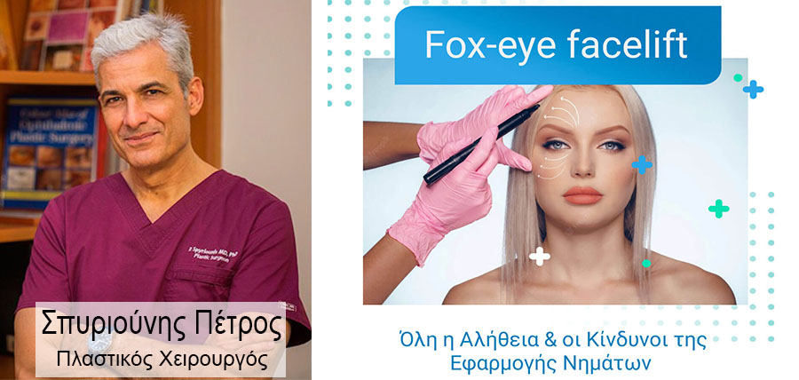 Fox-eye facelift. Όλη η αλήθεια & οι κίνδυνοι της εφαρμογής νημάτων cover image