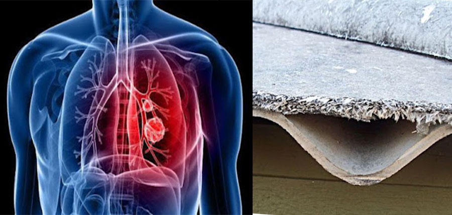 Τι είναι ο αμίαντος; Ποιους καρκίνους προκαλεί η εισπνοή σκόνης αμιάντου; cover image