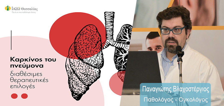 Καρκίνος του Πνεύμονα – Τα στάδια και οι θεραπείες article cover image
